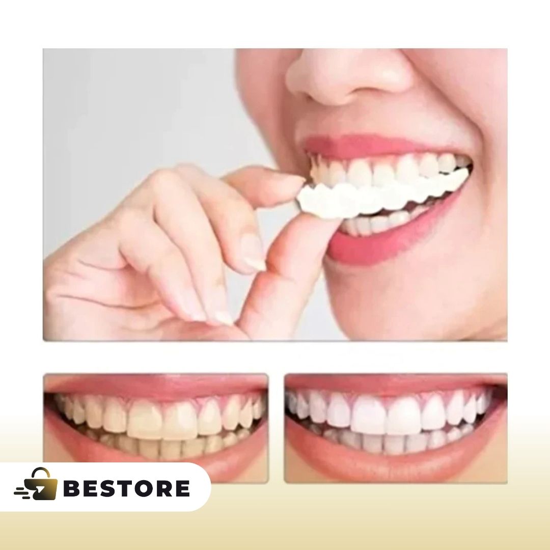 Carillas Dentales Removibles