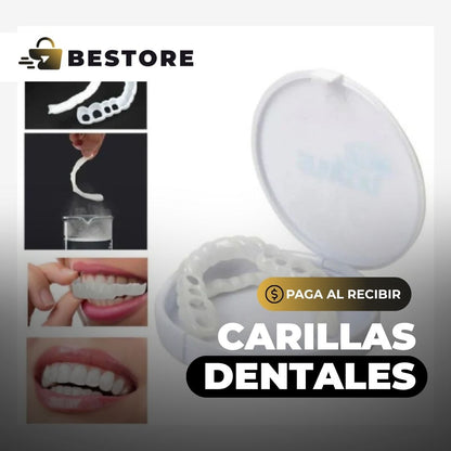 Carillas Dentales Removibles