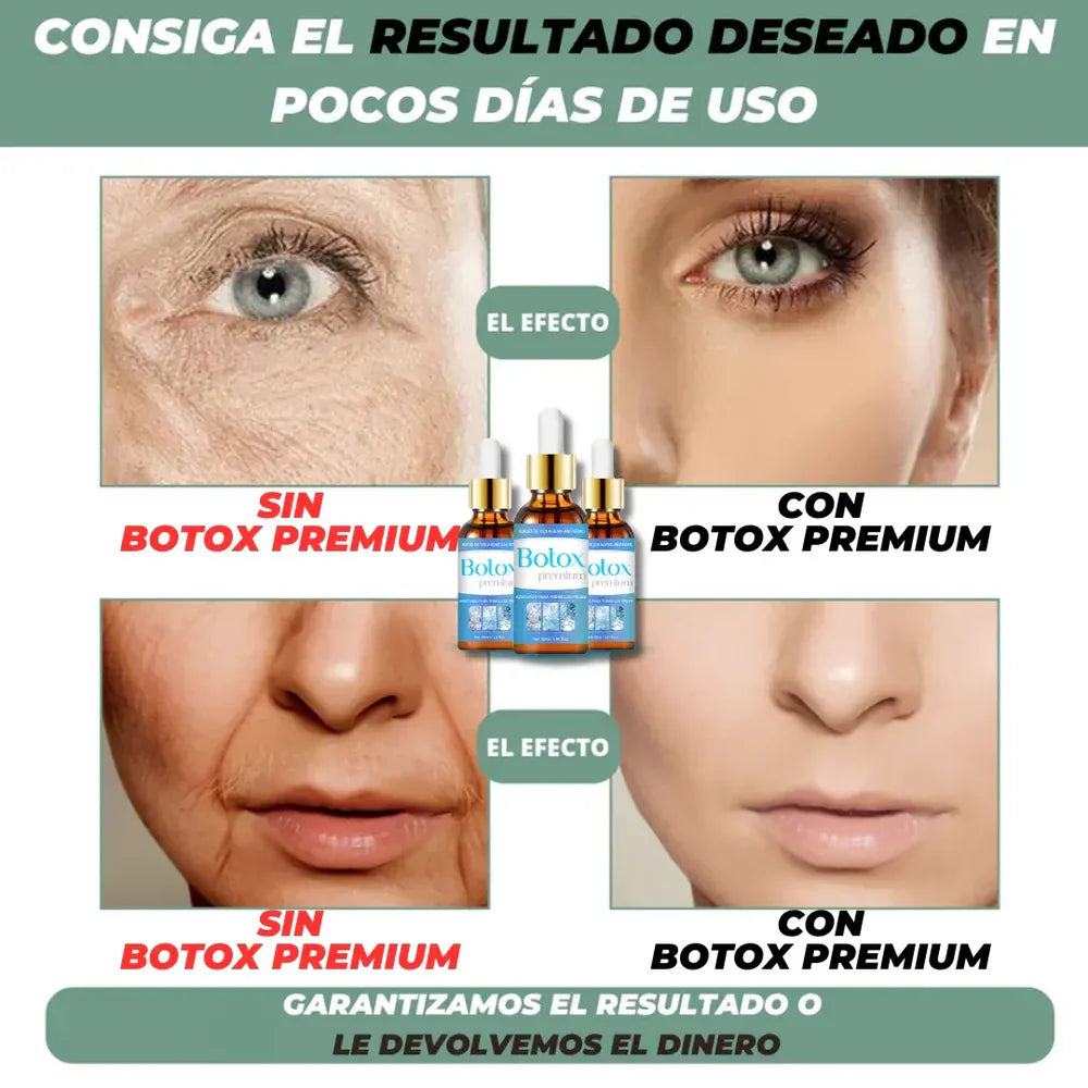 BOTOX PREMIUM™